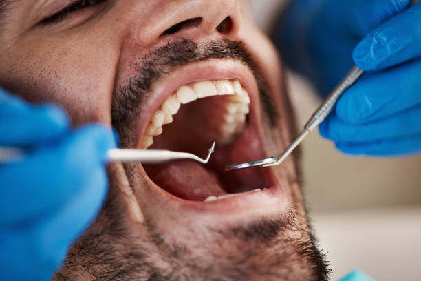 Best Dentist for Tooth Abscess  in Sherman, TX